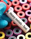 Toxic Invaders: How Heavy Metals Are Silently Hijjacking Your Health8
