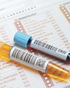 Timely medical tests: Why they matter?17