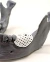 Australia manufactures 3D printed scaffolding to rebuild jaw bones