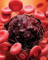 Immuneel unveils India's first global CAR T-cell therapy for Non-Hodgkin's Lymphoma