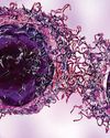 Scientists at IISc tweak cancer cell response to ultrasound treatment Scientists at IISc tweak cancer cell response to ultrasound treatment
