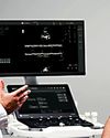 Wipro GE Healthcare launches AI enabled ultrasound system Versana Premier R3 Wipro GE Healthcare launches AI enabled ultrasound system Versana Premier R3