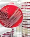 CrisprBits develops PathCrisp for early detection of antibiotic resistance CrisprBits develops PathCrisp for early detection of antibiotic resistance