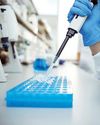 Parse Biosciences plans to release single cell chromatin accessibility products Parse Biosciences plans to release single cell chromatin accessibility products