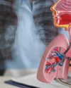 FIGHTING COPD IN INDIA INNOVATIONS AND CHALLENGES16
