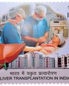 APOLLO HOSPITALS GROUP ACHIEVES LANDMARK SUCCESS WITH 5,000 LIVER TRANSPLANTS12