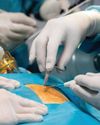 MINIMALLY INVASIVE BYPASS SAVES POSTTRANSPLANT CARDIAC PATIENT5