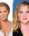 Amy Schumer Says 'Moon Face' Comments Led to Cushing's Syndrome Diagnosis