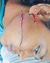 अमन विहार में छात्रा पर जानलेवा हमला अमन विहार में छात्रा पर जानलेवा हमला27