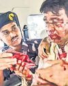 भीड़ ने भाजपा सांसद खगेन का सिर फोड़ा52