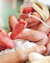समय पूर्व, कम वजनी बच्चा पैदा हो तो आंखों की जांच जरूर कराएं Hindustan Times Hindi