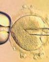 { MEDICAL BREAKTHROUGH IN UK } EIGHT HEALTHY BABIES HAVE BEEN BORN USING THIS TECHNIQUE Babies born from 3 people's DNA are free of genetic diseases58