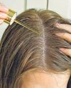 Feeling the burn? Here's how to protect your scalp this summer70