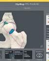 Knee and hip Arthroscopy by a US surgeon now in Delhi116