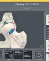 Knee and hip Arthroscopy by a US surgeon now in Delhi104