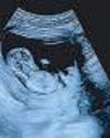 Pete Davidson is going to be dad, expecting first child with girlfriend81