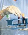 Govt to introduce advanced testing for imported blood products37