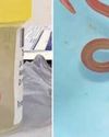 In a first, live worm found in woman's brain14