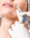 Here's how foam fillers are reshaping facial contours Manila Bulletin