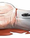 Two college students die as govt bus rams bike waiting at signal12
