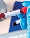 5 kids HIV+ after blood transfusion in Jharkhand; civil surgeon suspended14