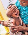 B’desh measles toll hits 194 kids, cases surge past 28,0004