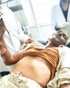 विद्युत लाइन पर कार्य करने के दौरान लाइनमैन झुलसा, जिला चिकित्सालय रेफर6