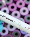Seven more Covid cases detected in State, tally rose to 4510