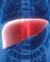 Study shows alcohol-linked liver deaths rising in women, young adults10