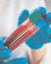 Deadly blood cancer can now be detected early with blood test: Study36
