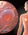 BMI may influence breast cancer risk in women with heart disease: WHO study38