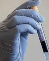 Blood tests pick up 95% of dementia