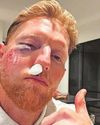 STOKES: I'M JUST LUCKY TO BE ALIVE53