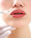 Lip filler dangers for young teens seeking surgery Lip filler dangers for young teens seeking surgery12