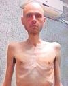 Emaciated...Ukrainian lost six stone in Russian prison camp Emaciated...Ukrainian lost six stone in Russian prison camp19