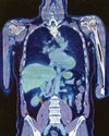 "Transformative' scanner to aid faster, earlier diagnoses "Transformative' scanner to aid faster, earlier diagnoses