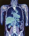 "Transformative' scanner to aid faster, earlier diagnoses