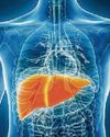 Liver cancer soars in last two decades