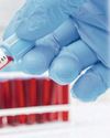 NHS ROLLS OUT WORLD-FIRST CANCER TEST0