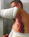 Angler feared he was dead after lightning struck tree beside him55