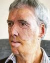 3D-printed face helped cyclist rebuild his life 3D-printed face helped cyclist rebuild his life39