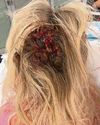 Nurse beaten with a crowbar at work2