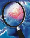 Drug trials are start of a 'cure for dementia..'23