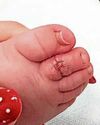 Mum's warning over her baby's hair toe trauma Mum's warning over her baby's hair toe trauma24
