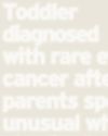 Toddler diagnosed with rare eye cancer after parents spot unusual white glow in photos Toddler diagnosed with rare eye cancer after parents spot unusual white glow in photos