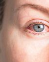 FOCUS ON GLAUCOMA28
