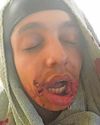 ‘XL bully’ attack leaves man covered in blood4