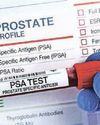 As Jeremy Clarkson tells of prostate cancer diagnosis, how can men over 60 spot the symptoms?25