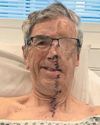 Cyclist has face rebuilt after horror crash – on a 3D printer11