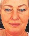 Grandma died from rabies after stray dog scratch19
